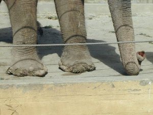 elephant feet osteomyelitis